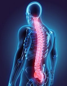 Spinal Cord Injuries: What Workers Need to Know