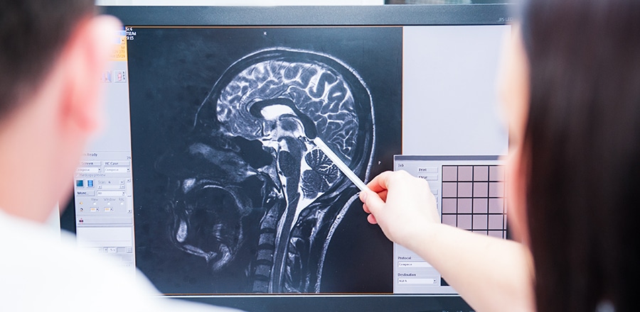 Chattanooga Brain Injury Lawyers